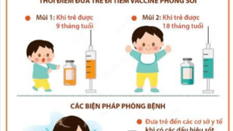 Bài tuyên truyền phòng chống bệnh Sởi năm 2025